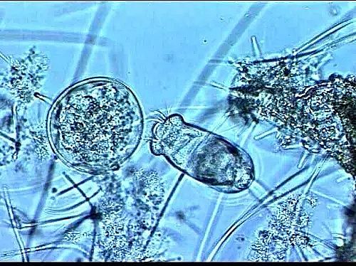 ��x�Ӿ۱�ϩ����CPAM���a�S�ҡ�����������Û���@Щԭ��