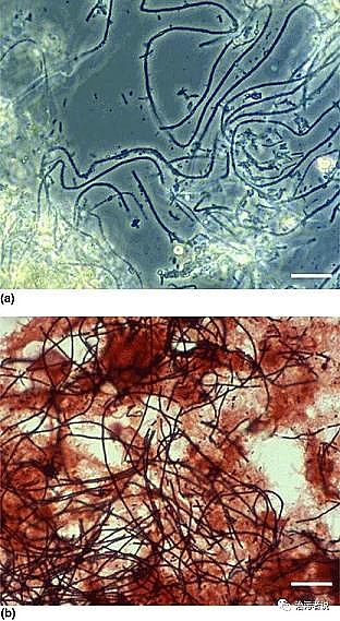 ��Ʒ�|Ҭ������̿�S����Û����ĭ��M. parvicella���ĺ���